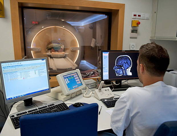 Bellvitge realiza la primera resonancia magnética en España a un paciente con TOC tratado con electrodos cerebrales